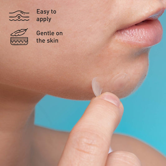 Hydrocolloid Pimple Patch, 120-Count, Multi Size Acne Solution 5 Pack